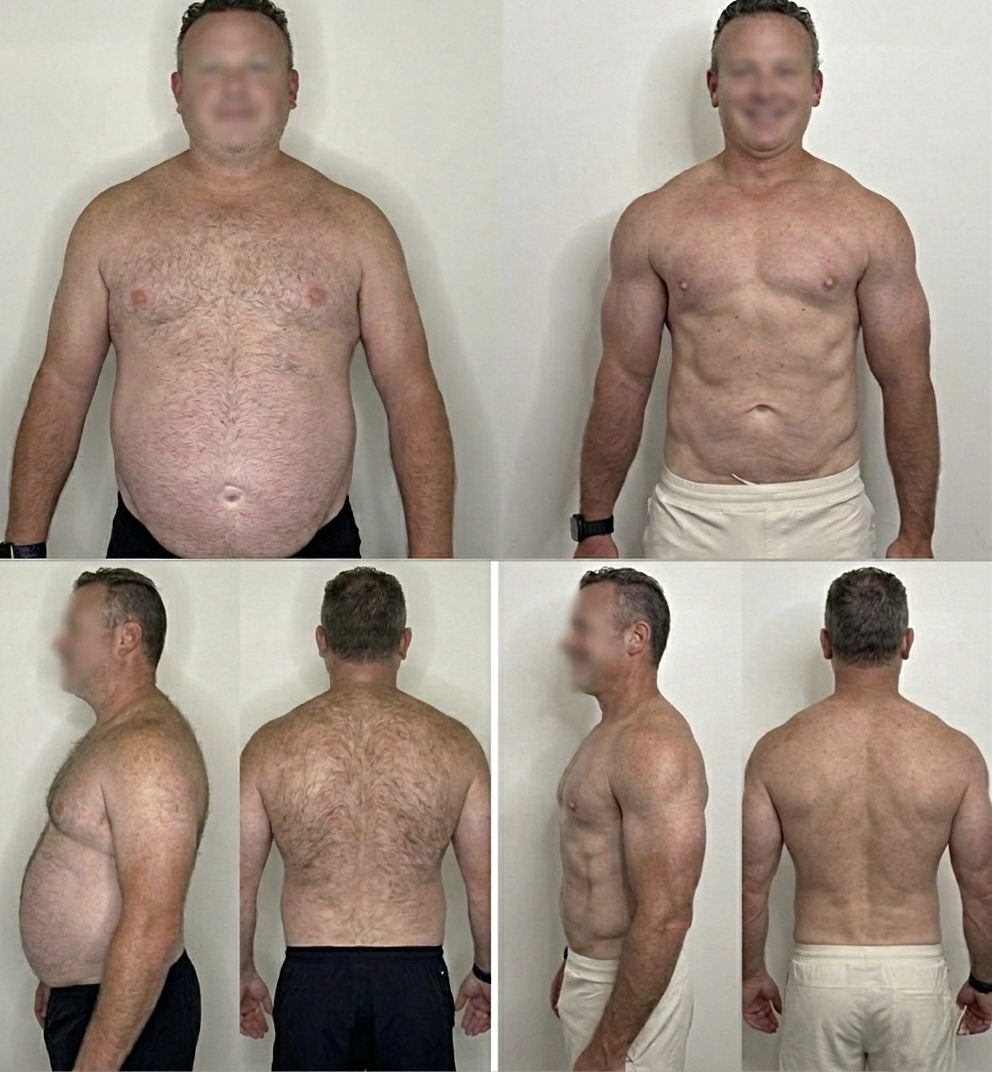 Antes e depois 1