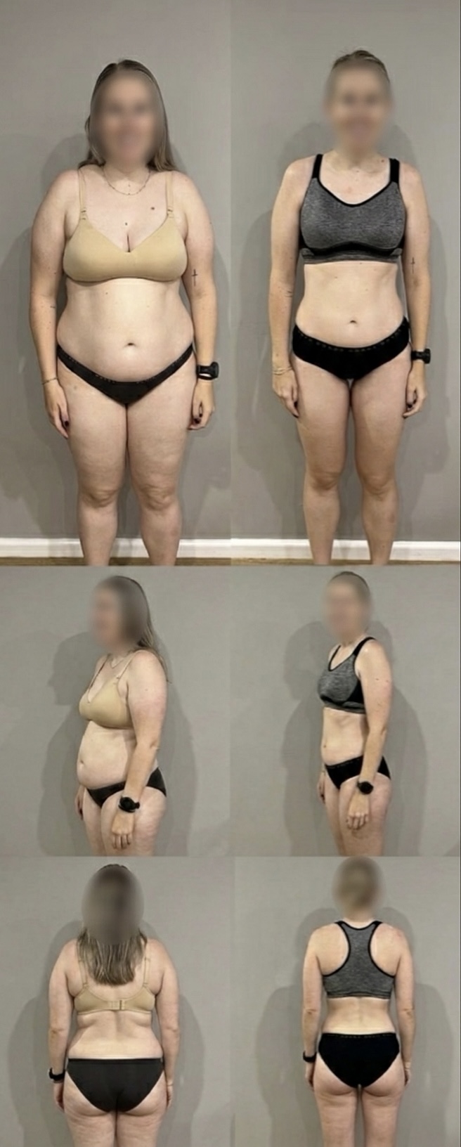 Antes e depois 2