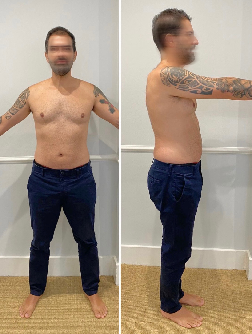 Antes e depois 3