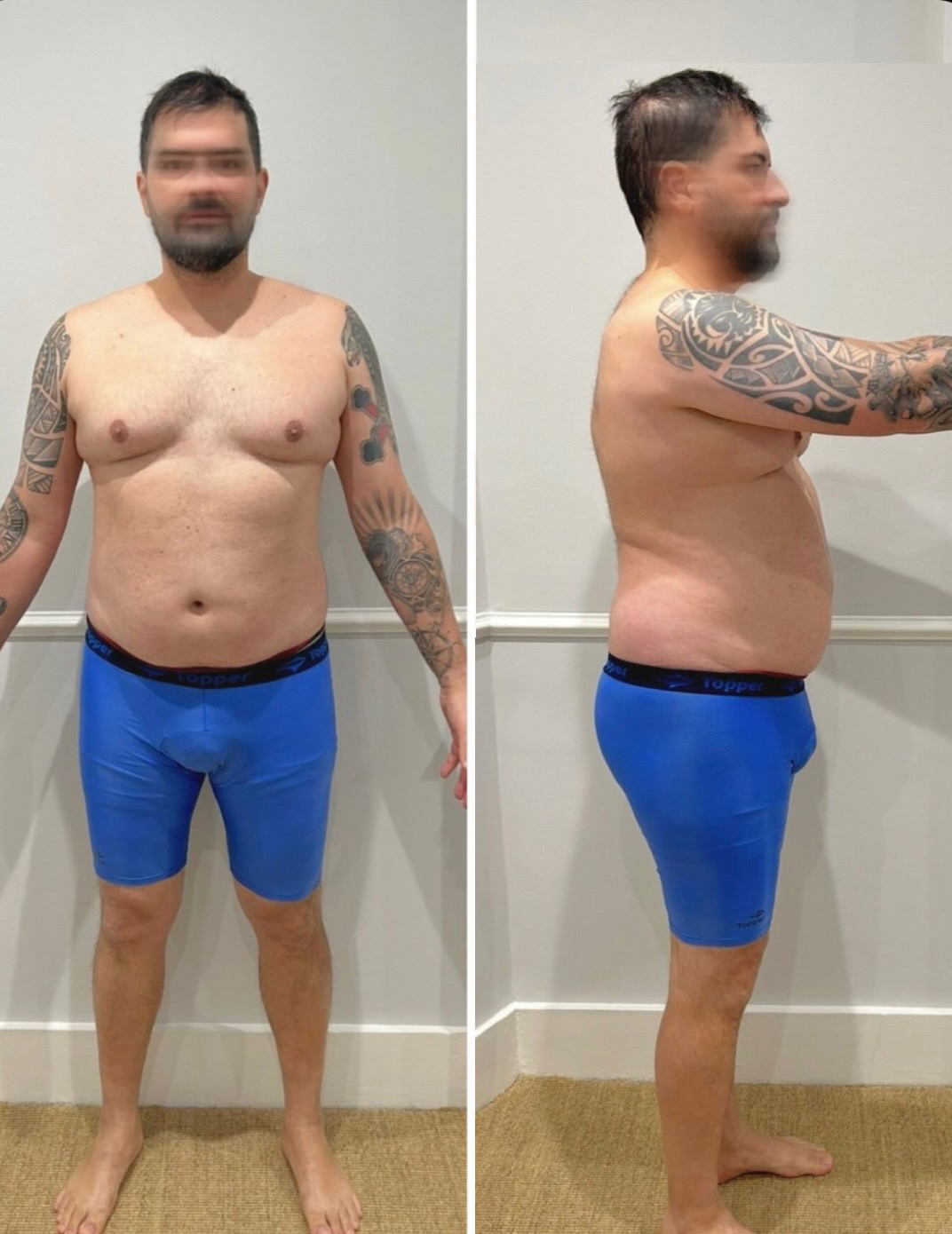 Antes e depois 4