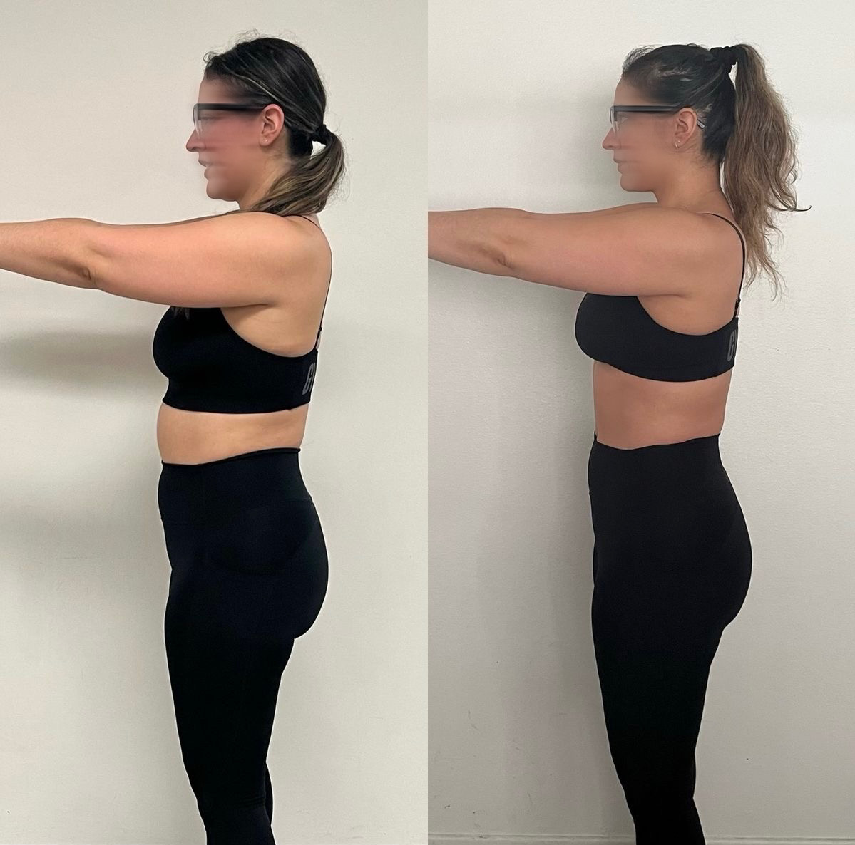 Antes e depois 2