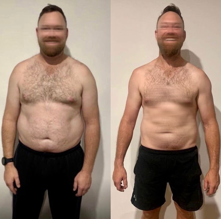 Antes e depois 1